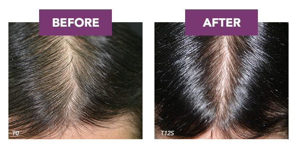 2.5X LESS* HAIR LOSS