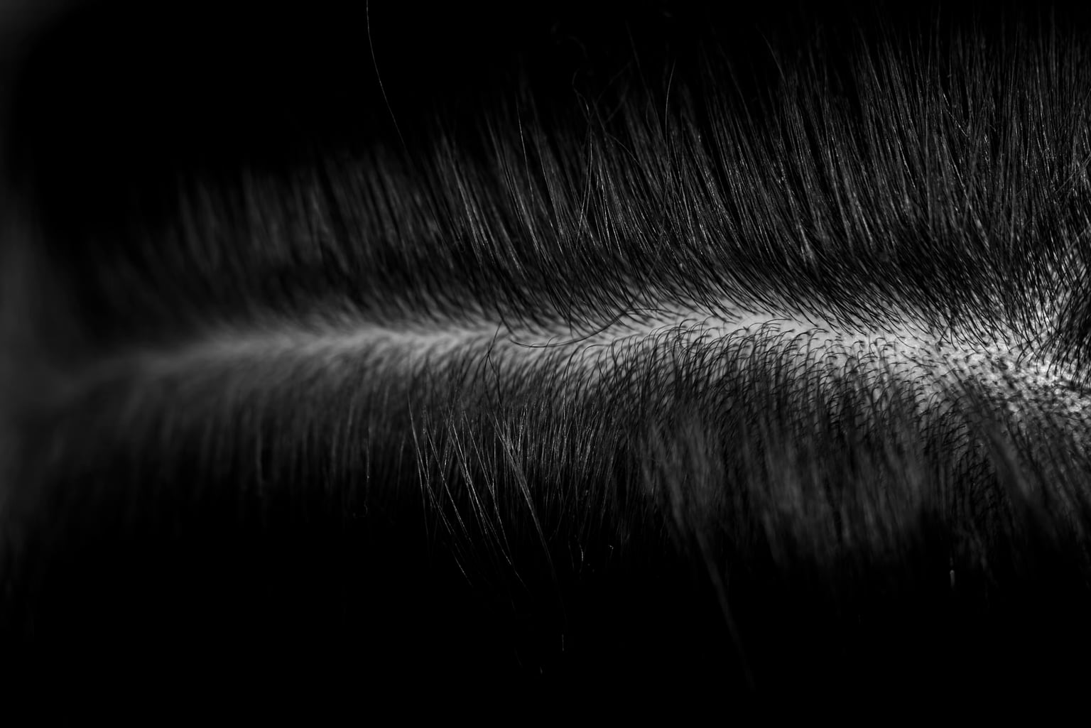 Dandruff and Scalp Itching: What Really Causes Them — and How to Act