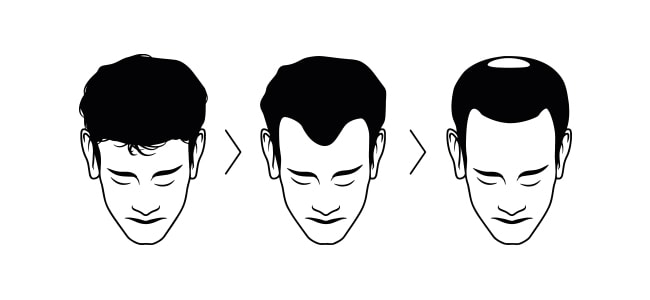Men